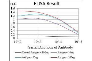 Black line: Control Antigen (100 ng), Purple line: Antigen(10 ng), Blue line: Antigen (50 ng), Red line: Antigen (100 ng), (p130 anticorps  (AA 939-1139))