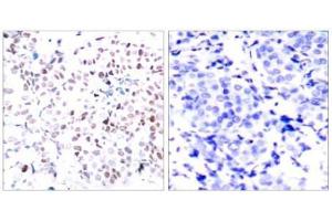 Image no. 3 for anti-Myc Proto-Oncogene protein (MYC) (pThr358) antibody (ABIN196675) (c-MYC anticorps  (pThr358))