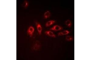 Immunofluorescent analysis of IDH1 staining in A549 cells.