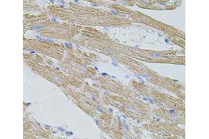 Immunohistochemistry of paraffin-embedded Mouse heart using TRPA1 Polyclonal Antibody at dilution of 1:100 (40x lens).