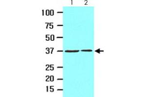 Cell lysates of HeLa (lane 1) and 293T (lane 2) (20 ug) were resolved by SDS-PAGE and probed with EPM2A monoclonal antibody, clone k2A3  (1:1000). (EPM2A anticorps  (AA 243-331))