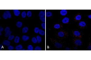 Immunocytochemistry/Immunofluorescence analysis using Mouse Anti-VPS35 Monoclonal Antibody, Clone 7E4 (ABIN6932908). (VPS35 anticorps)