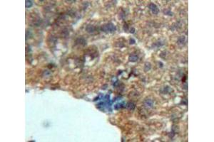 Used in DAB staining on fromalin fixed paraffin-embedded Liver tissue (Growth Hormone 1 anticorps  (AA 28-216))