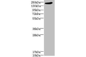 Western blot All lanes: LRP4 antibody at 1. (LRP4 anticorps  (AA 1500-1725))