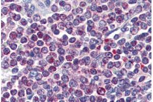 Human Spleen (formalin-fixed, paraffin-embedded) stained with NFATC1 antibody ABIN364442 at 10 ug/ml followed by biotinylated anti-mouse IgG secondary antibody ABIN481714, alkaline phosphatase-streptavidin and chromogen.
