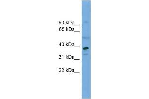 WB Suggested Anti-APEX1  Antibody Titration: 0. (APEX1 anticorps  (Middle Region))