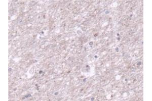 Detection of TOMM70A in Human Cerebrum Tissue using Polyclonal Antibody to Translocase Of Outer Mitochondrial Membrane 70A (TOMM70A)