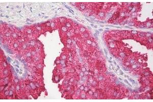 Image no. 2 for anti-Interleukin 27 (IL27) (C-Term) antibody (ABIN6749775) (IL-27 anticorps  (C-Term))