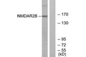 Western blot analysis of extracts from Jurkat cells, using NMDAR2B (Ab-1474) Antibody. (GRIN2B anticorps  (AA 1435-1484))