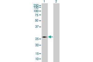 Western Blot analysis of PMM2 expression in transfected 293T cell line by PMM2 MaxPab polyclonal antibody. (PMM2 anticorps  (AA 1-246))