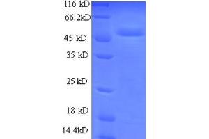 SDS-PAGE (SDS) image for Ubiquinol-Cytochrome C Reductase Iron-Sulfur Subunit, Mitochondrial Precursor (Rieske Iron-Sulfur Protein) (RISP) (UCRI) (AA 79-274) protein (GST tag) (ABIN5712359) (UCRI Protein (AA 79-274) (GST tag))