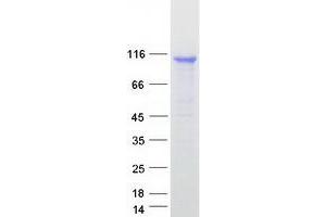 DEAD (Asp-Glu-Ala-Asp) Box Polypeptide 58 (DDX58) protein (Myc-DYKDDDDK Tag)