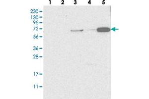 Western blot analysis of Lane 1: RT-4, Lane 2: U-251 MG, Lane 3: Human Plasma, Lane 4: Liver, Lane 5: Tonsil with SH3TC2 polyclonal antibody .