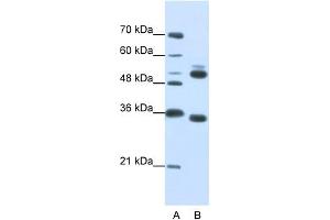 WB Suggested Anti-WDR6  Antibody Titration: 0. (WDR6 anticorps  (C-Term))