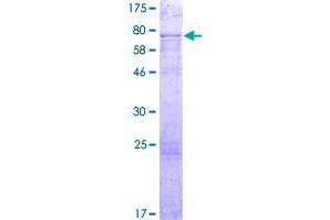 Image no. 1 for S100P Binding Protein (S100PBP) (AA 1-408) protein (GST tag) (ABIN1319086)