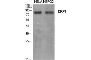 Western Blot (WB) analysis of specific cells using DRP1 Polyclonal Antibody.