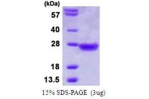 SDS-PAGE (SDS) image for MAD2 Mitotic Arrest Deficient-Like 1 (Yeast) (MAD2L1) (AA 1-205) protein (His tag) (ABIN6386805)