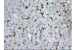 Immunohistochemistry (IHC) image for anti-Aldehyde Dehydrogenase 3 Family, Member A1 (ALDH3A1) antibody (ABIN1496591) (ALDH3A1 anticorps)