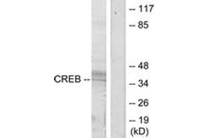 Western blot analysis of extracts from HeLa cells, treated with UV, using CREB (Ab-133) Antibody. (CREB1 anticorps  (AA 100-149))