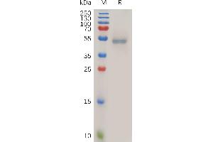 Human FASLG Protein, N-hFc Tag on SDS-PAGE under reducing condition.
