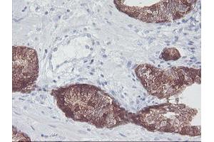 Image no. 3 for anti-Interferon Regulatory Factor 6 (IRF6) antibody (ABIN1498901)