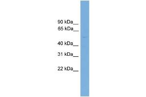 WB Suggested Anti-GBA3 Antibody Titration: 0. (GBA3 anticorps  (N-Term))
