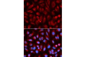 Immunofluorescence analysis of U2OS cell using ADA antibody. (ADA anticorps  (AA 1-363))