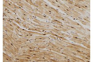 ABIN6269012 at 1/100 staining Rat heart tissue by IHC-P. (HSP70 1A anticorps  (C-Term))