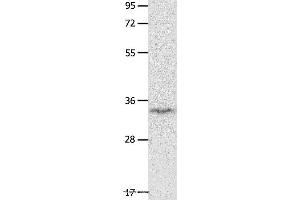 Western blot analysis of Mouse brain tissue, using IGFBP7 Polyclonal Antibody at dilution of 1:400 (IGFBP7 anticorps)