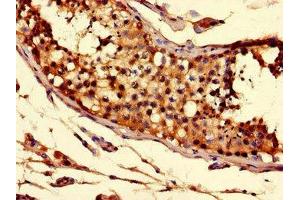 Immunohistochemistry of paraffin-embedded human testis tissue using ABIN7170279 at dilution of 1:100