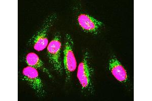 HeLa cells staining with CPCA-LaminAC (red), and counterstained with monoclonal antibody to Lysosomal Associated Membrane Protein 1 (Lamp1), MCA- 6E2 (green) and DNA (blue). (Lamin A/C anticorps)