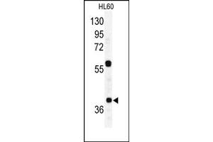 Image no. 2 for anti-RAD23 Homolog A (RAD23A) (C-Term) antibody (ABIN357606) (RAD23A anticorps  (C-Term))