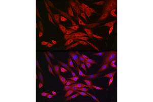 Immunofluorescence analysis of NIH/3T3 cells using MRPL28 Rabbit mAb (ABIN7268566) at dilution of 1:100 (40x lens).