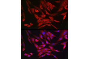 Immunofluorescence analysis of NIH/3T3 cells using MRPL28 Rabbit mAb (ABIN7268566) at dilution of 1:100 (40x lens). (MRPL28 anticorps)