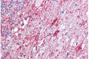 Anti-ATG9A antibody IHC staining of human brain, cerebellum. (ATG9A anticorps  (C-Term))