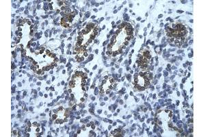 Rabbit Anti-USE1 Antibody       Paraffin Embedded Tissue:  Human alveolar cell   Cellular Data:  Epithelial cells of renal tubule  Antibody Concentration:   4.