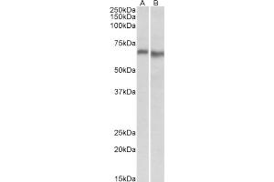 AP21300PU-N AMPK2 antibody staining of Mouse (A) and Rat (B) Heart lysate at 0. (PRKAA2 anticorps  (Internal Region))