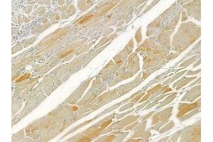 ABIN6260380 and ABIN6276612 at 1/100 staining human tongue carcinoma by IHC-P. (CA3 anticorps  (N-Term))
