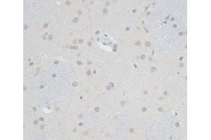 Immunohistochemistry of paraffin-embedded Rat brain using ZNF703 Polyclonal Antibody at dilution of 1:100 (40x lens). (ZNF703 anticorps)