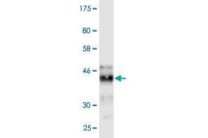 Western Blot detection against Immunogen (40. (IFITM3 anticorps  (AA 1-133))