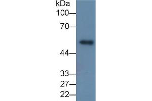 Detection of MMP8 in Porcine Skin lysate using Monoclonal Antibody to Matrix Metalloproteinase 8 (MMP8) (MMP8 anticorps  (AA 101-467))