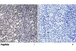 Immunohistochemistry analysis of paraffin-embedded human tonsil tissue using MRPS16 polyclonal antibody . (MRPS16 anticorps)