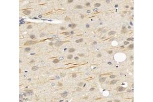 Immunohistochemistry analysis of paraffin-embedded rat brain using,SCN8A (ABIN7075647) at dilution of 1: 1200