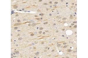Immunohistochemistry analysis of paraffin-embedded rat brain using,SCN8A (ABIN7075647) at dilution of 1: 1200 (SCN8A anticorps)