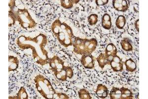 Image no. 1 for anti-CoA Synthase (COASY) (AA 461-565) antibody (ABIN466246) (COASY anticorps  (AA 461-565))