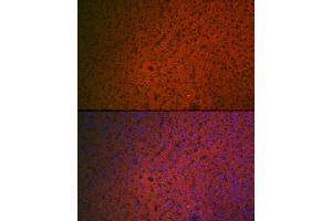 Immunofluorescence analysis of rat liver cells using Factor IX / F9 Rabbit pAb (ABIN3022173, ABIN3022174, ABIN3022175, ABIN1512886 and ABIN6218646) at dilution of 1:100 (40x lens). (Coagulation Factor IX anticorps  (AA 29-192))