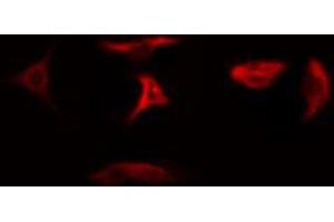 anti-Ribosomal Protein L5 (RPL5) (C-Term) antibody