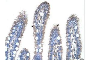 Image no. 1 for anti-Ornithine Carbamoyltransferase (OTC) (N-Term) antibody (ABIN203390)