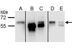 IP Image Sample (ug of whole cell lysate) A: 293 (input) B: control rabbit IgG-IP C: Stau1-IP , D: Post-IP lysate from control rabbit IgG-IP E:Post-IP lysate from Stau1-IP 7. (STAU1/Staufen anticorps  (C-Term))