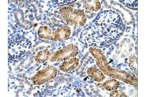 Image no. 1 for anti-Purinergic Receptor P2X, Ligand Gated Ion Channel 2 (P2RX2) (AA 106-155) antibody (ABIN203093)